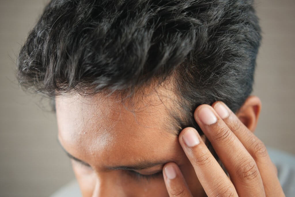 Créatine et perte de cheveux